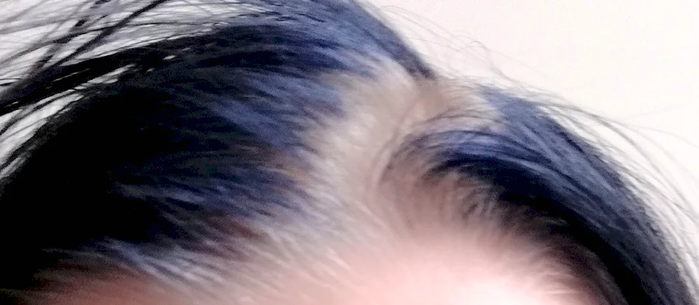 Grey roots on black hair