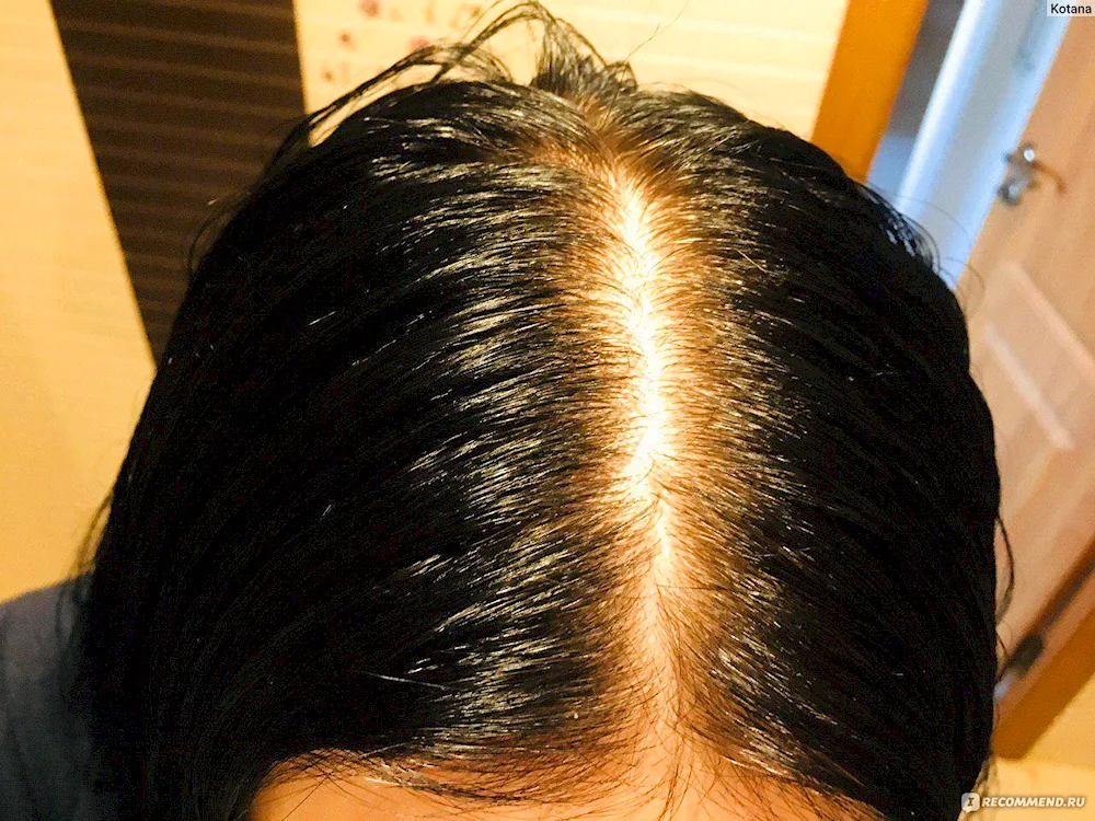 Outgrown roots on dark hair