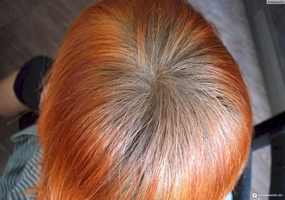 Faded roots on red hair