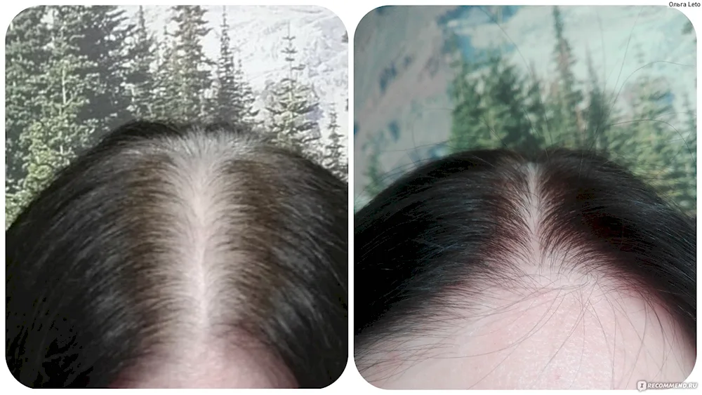 Black hair with outgrown roots on black hair