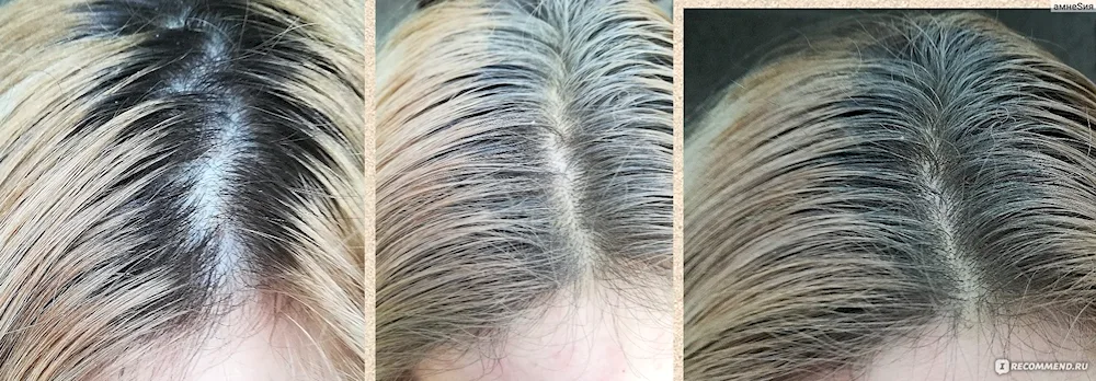 Grey roots on dark hair