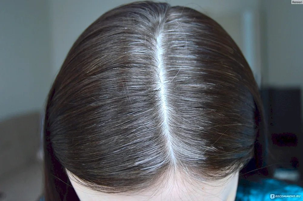 Grey Haire