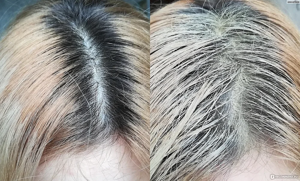 Grey hair colouring