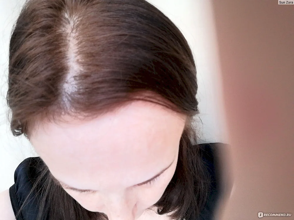 Outgrown roots on black hair