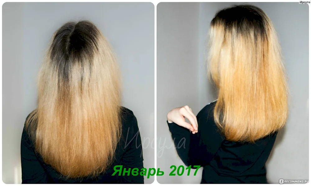 Hair growth before and after