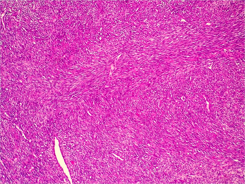 Hyaline cartilage histology