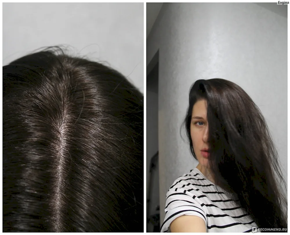 Pepel chestnut before and after