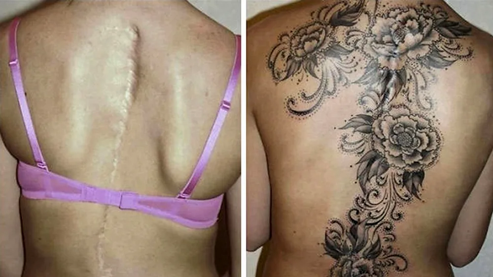 Tattoo to cover scars with tattoo