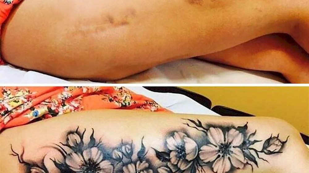 Stretch Marks Covering Tattoo