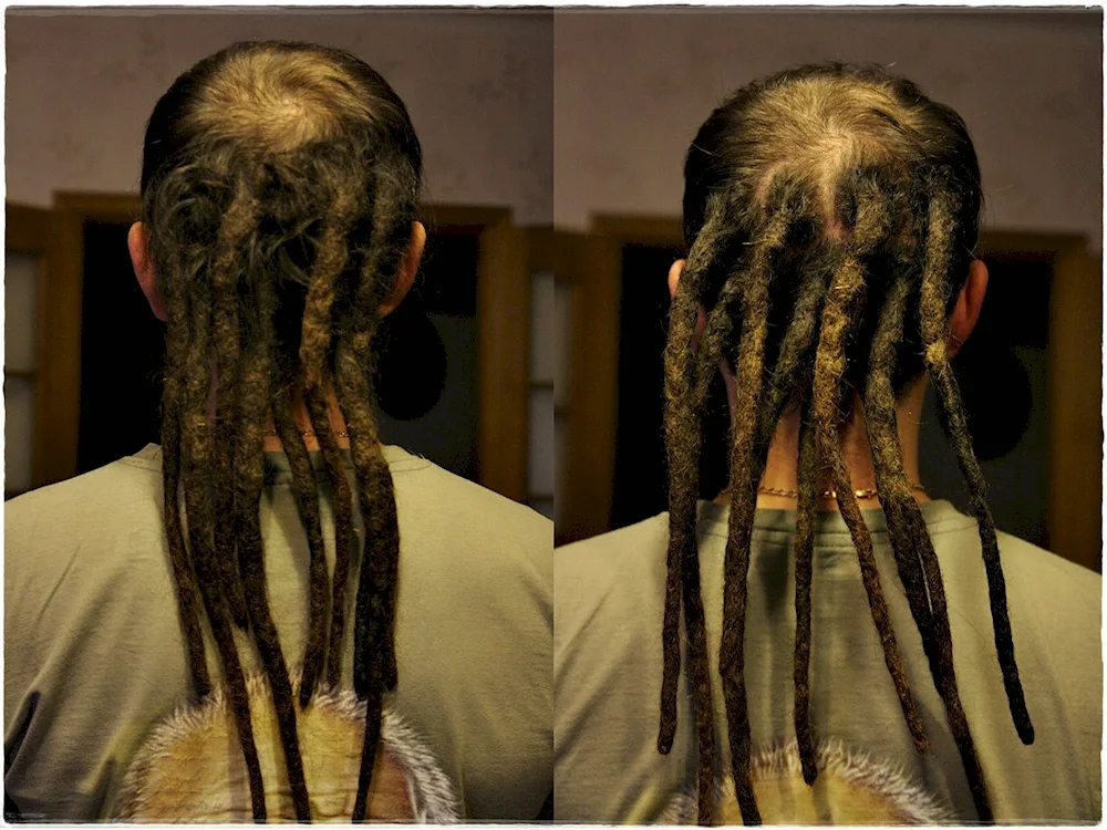 Dreadlock braids