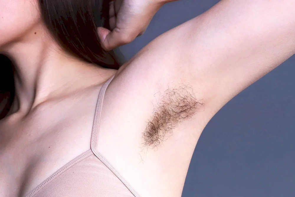 Sudden armpits