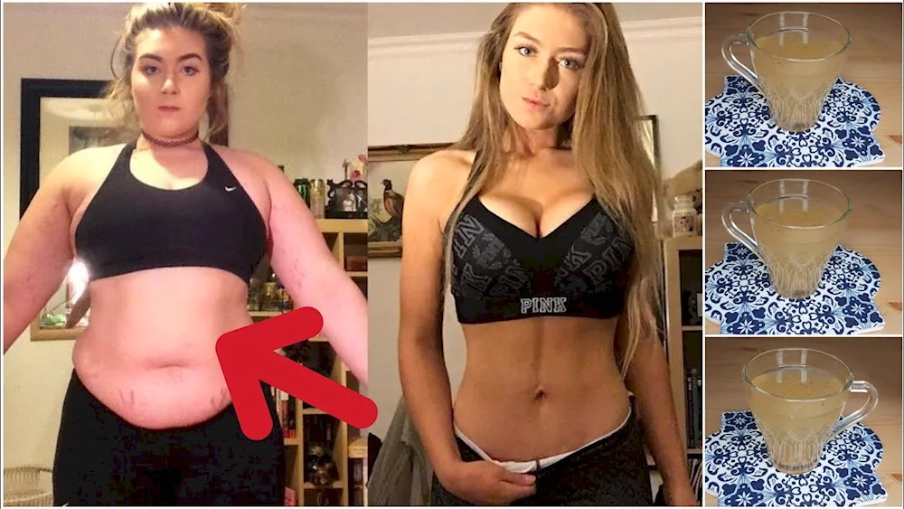 Losing weight before and after