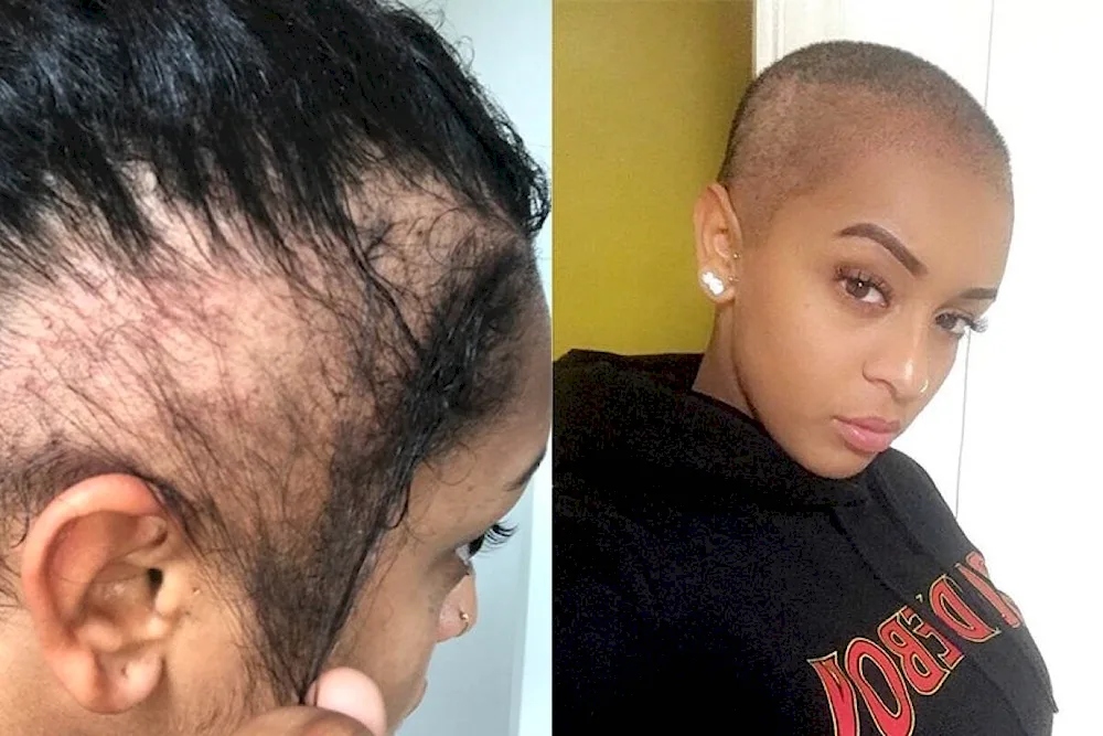 Half of the head shaved