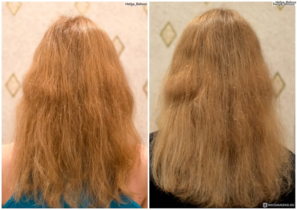 Damaged hair