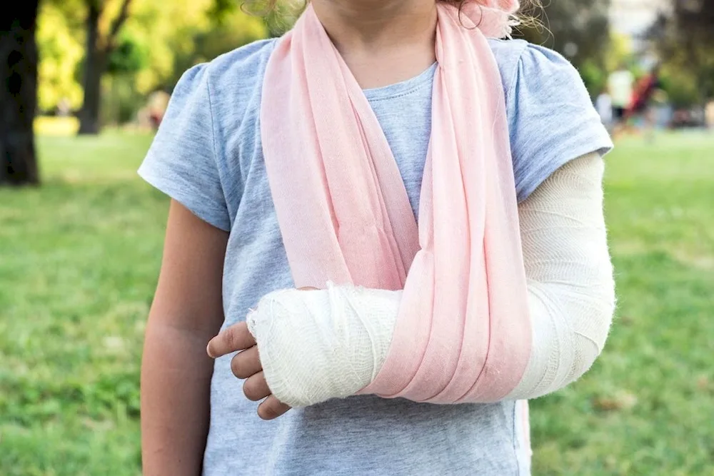 Bandage on the arm with a fracture