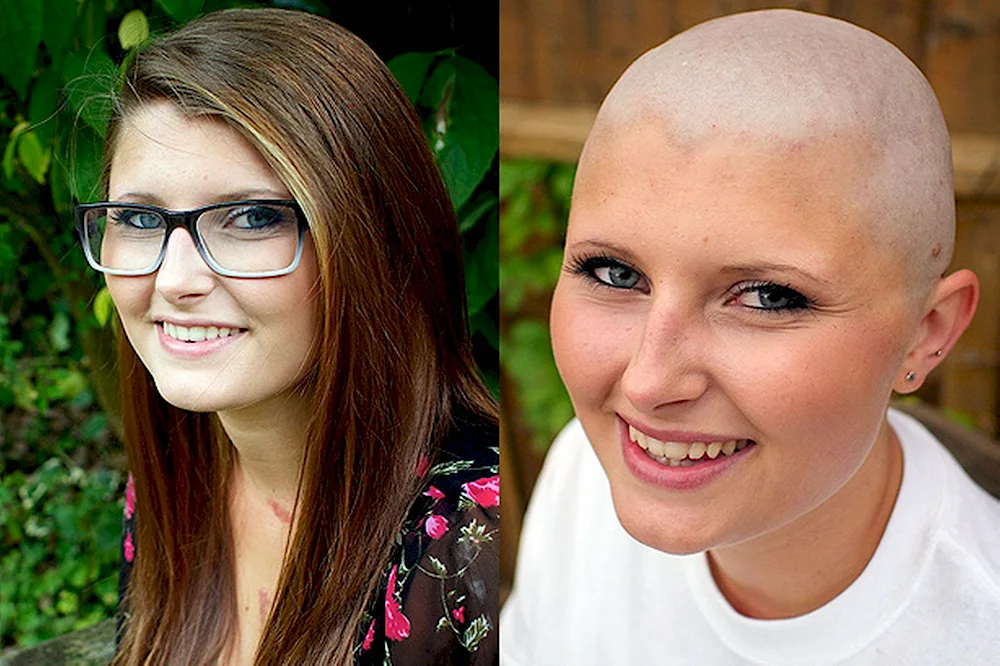 Hair cut after chemotherapy
