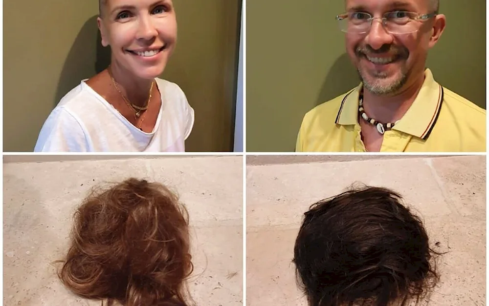 Photoshoot of bald girls