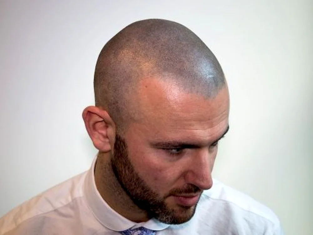 Hirstyles for balding men