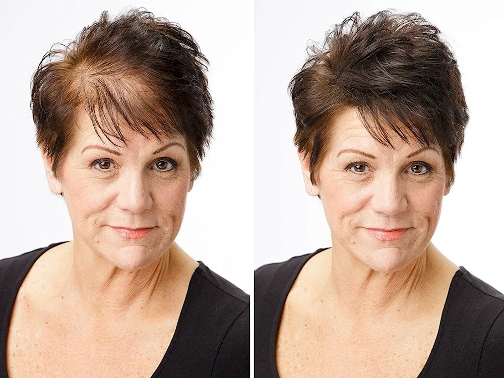 Hairstyles for balding women