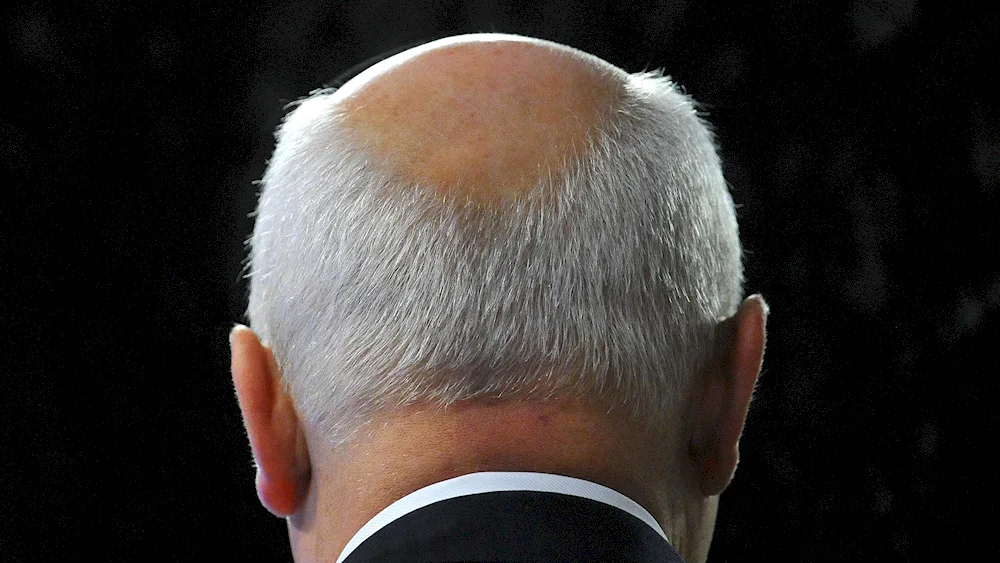 Bald hairstyles