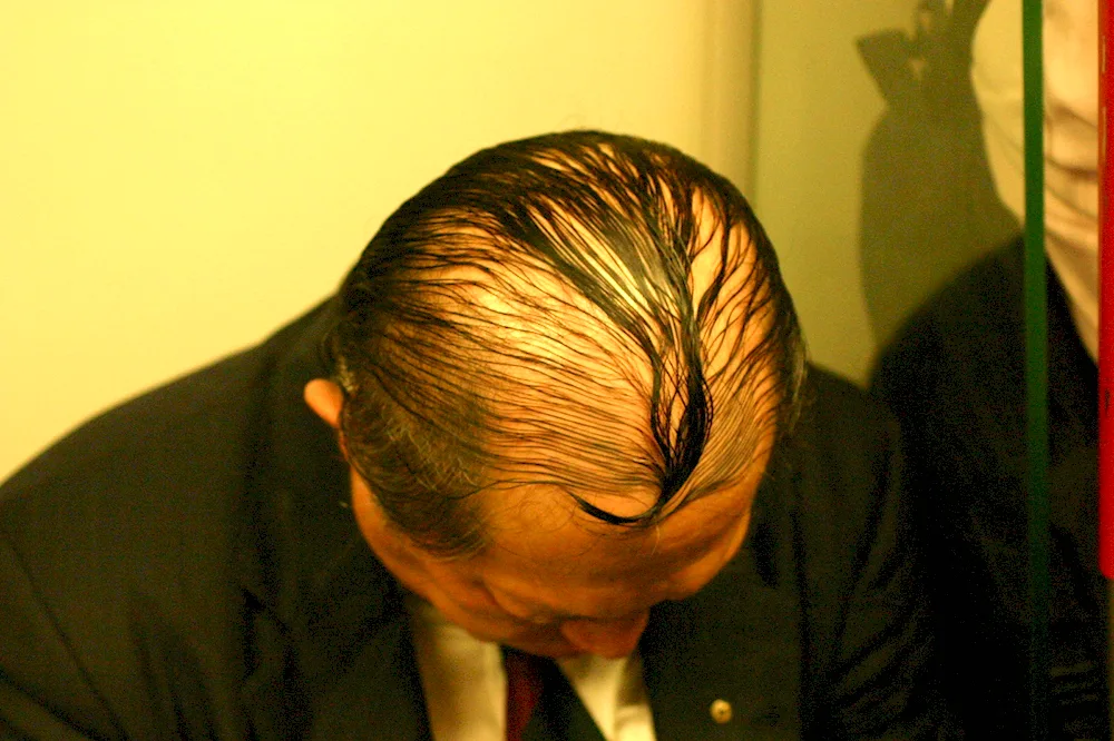 Hairstyles with baldness