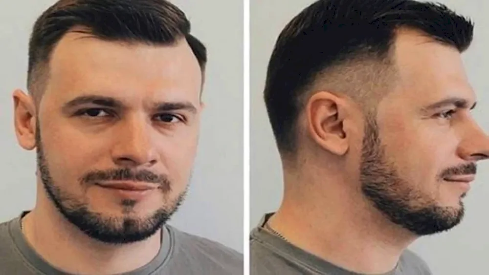 Haircuts for men with bald patches on forehead