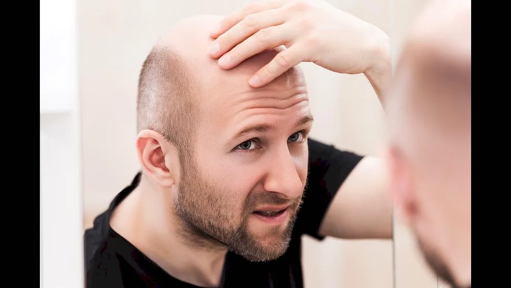 Hairstyles with baldness on the top of the head