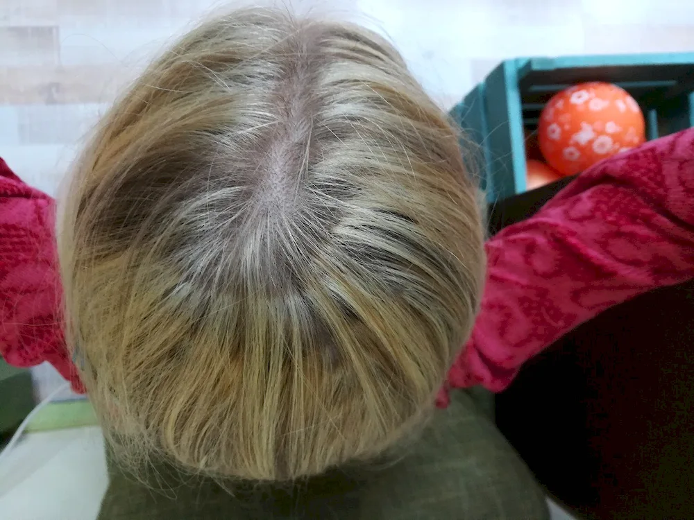 Backcombing