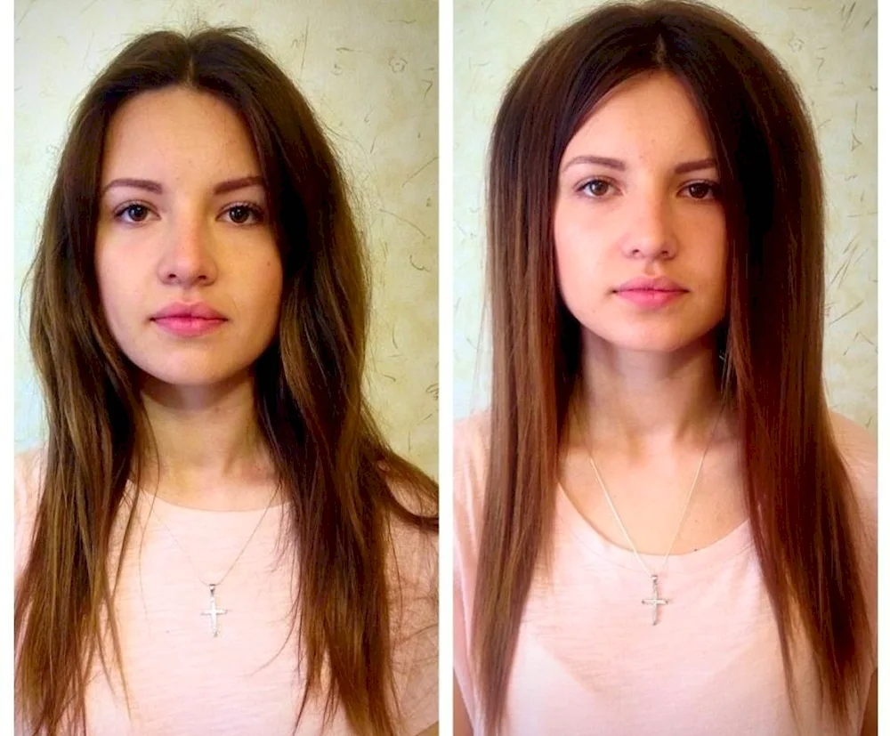 Beauty bump up