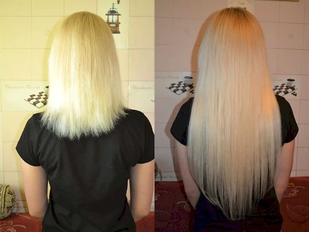 Profiled ends