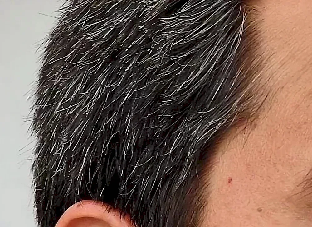 Early Grey hair