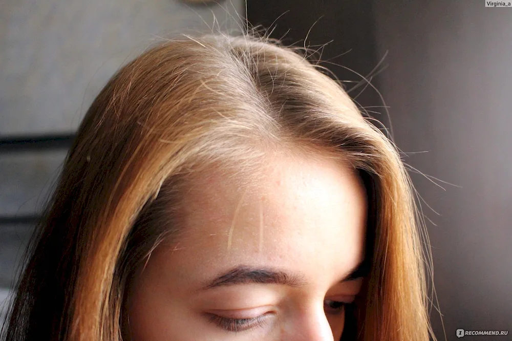 Very rare hair