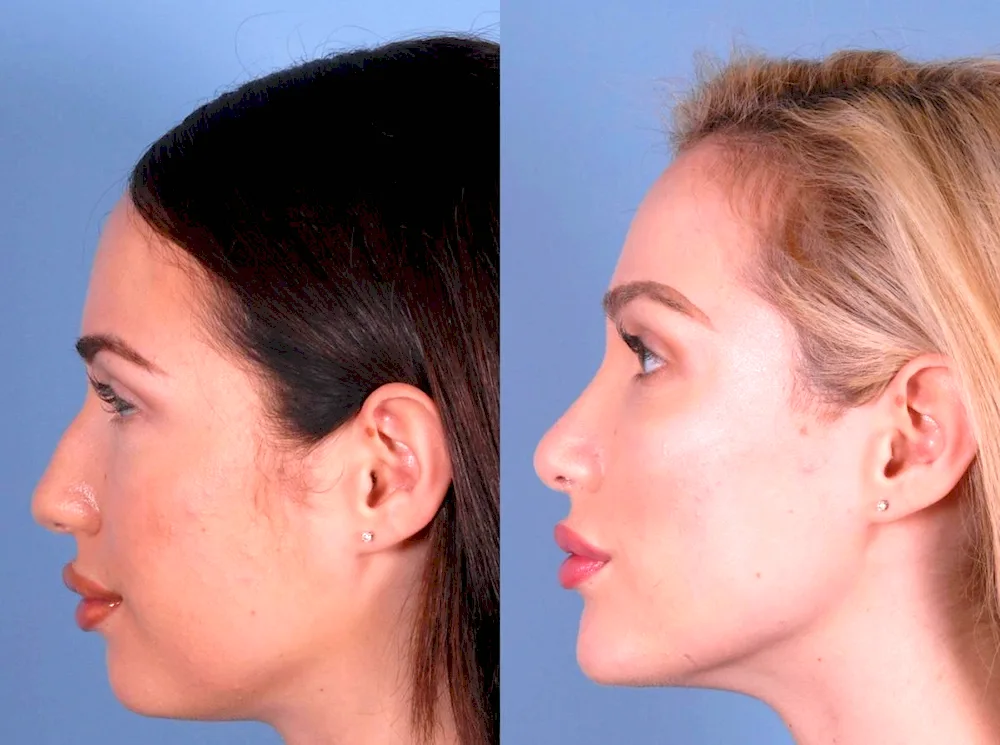 Maria Valverde hump profile