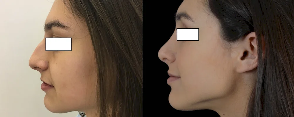 Jessica Biel in profile