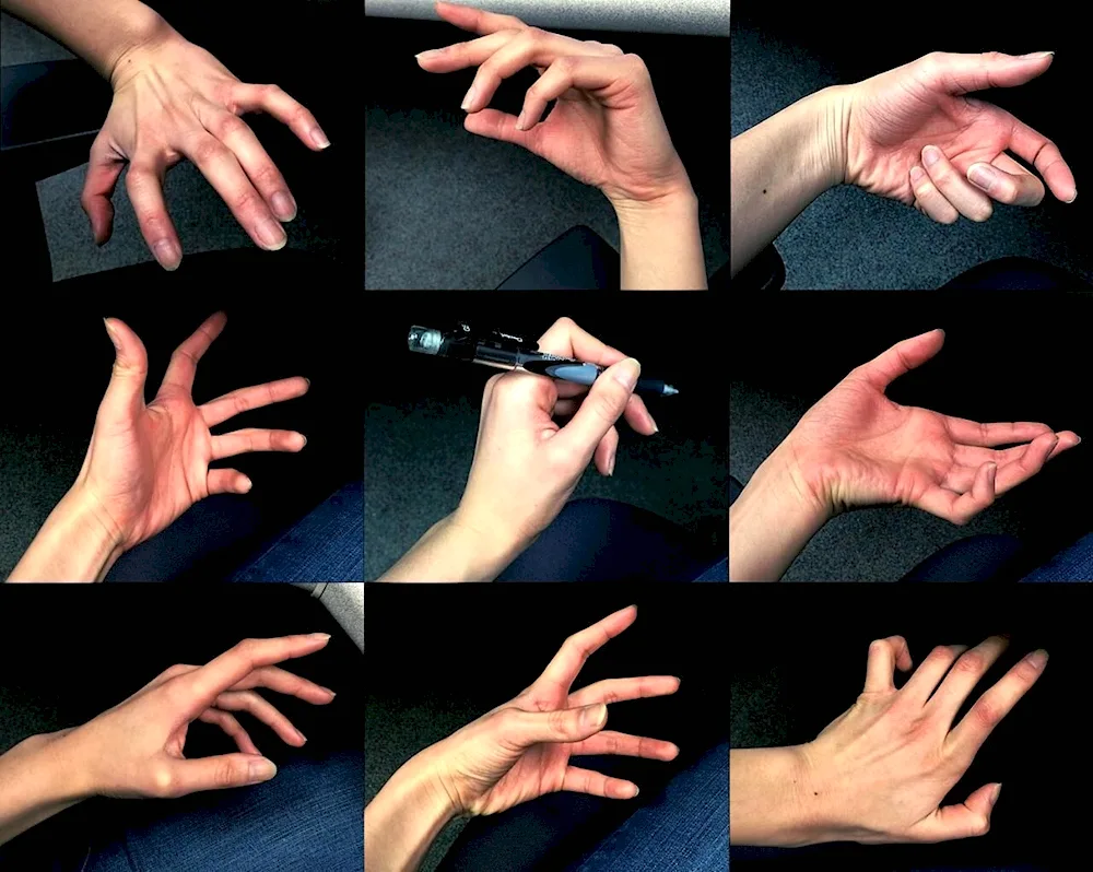Hand HandAnatomy