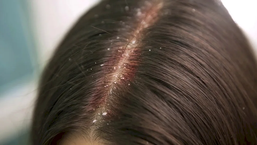 Rare Women's Hair
