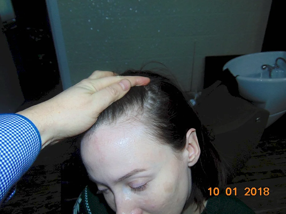 South hair