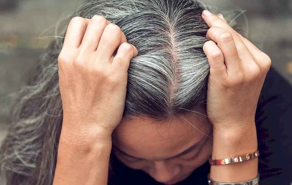 Grey hair