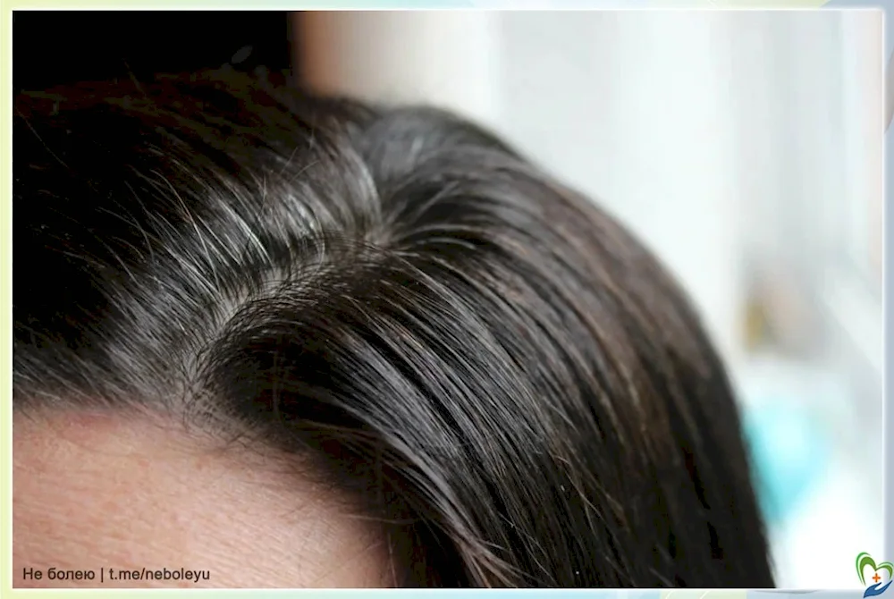 Dyeing grey on dark hair