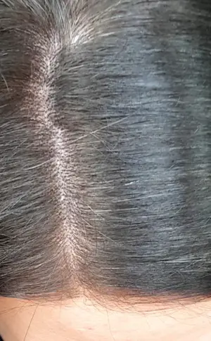 Grey roots on dark hair