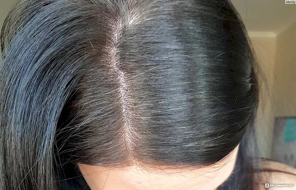 Grey roots on dark hair