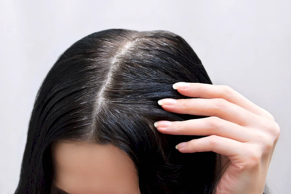 Daphne Hicks Grey hair