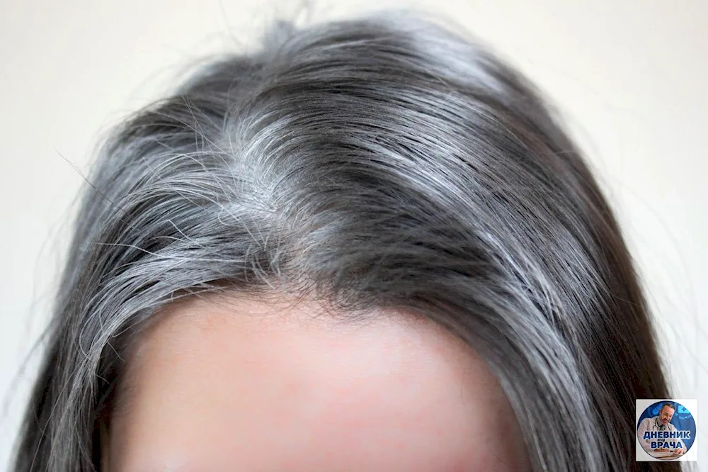 Daphne Hicks Grey hair