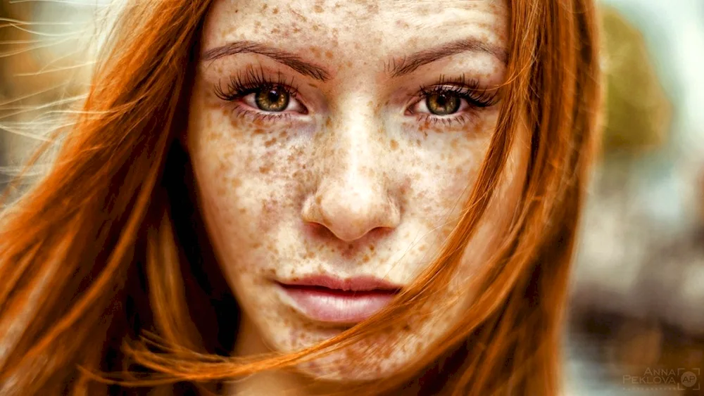 Selina Skinder has freckles