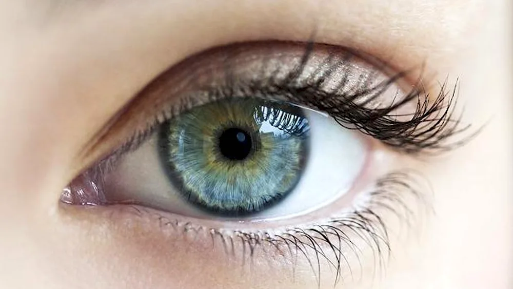 Central heterochromia kare- green