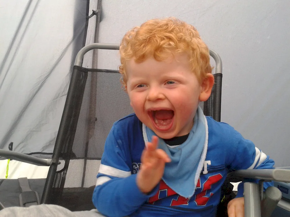 Syndrome Angelman's disease