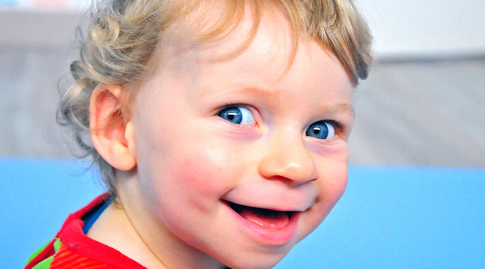 Angelman syndrome happy doll syndrome