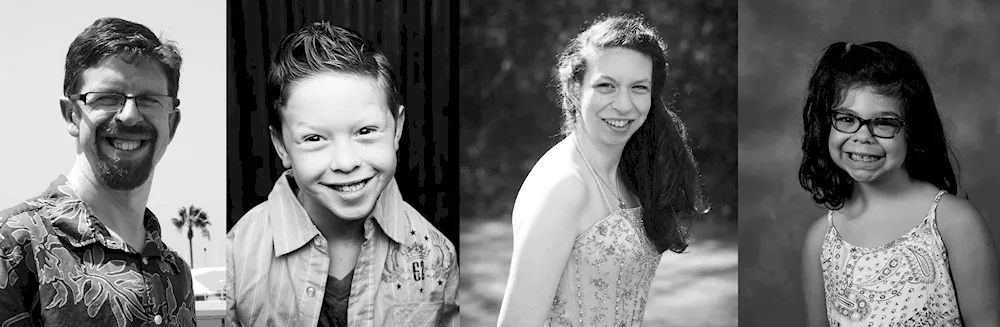 Williams syndrome face elfa