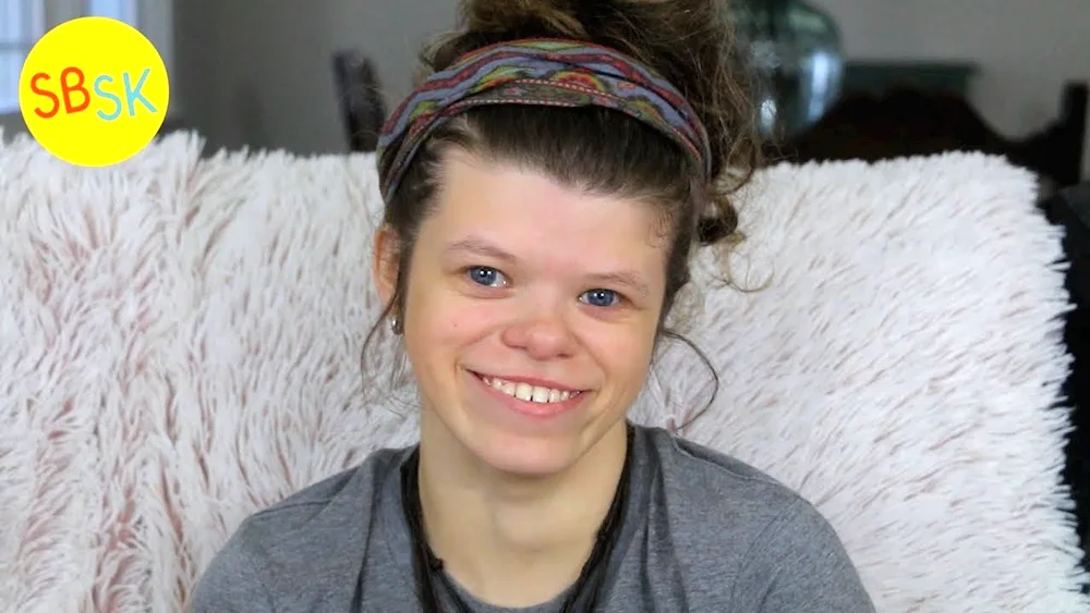 Williams syndrome Williams syndrome elfa syndrome