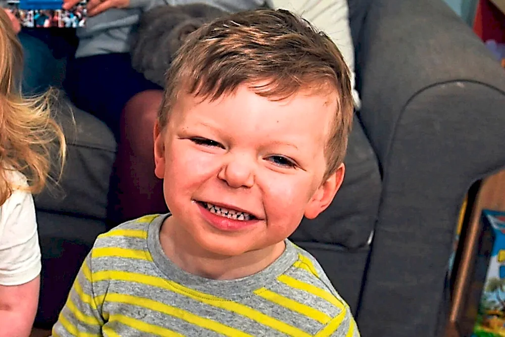 Williams syndrome adults
